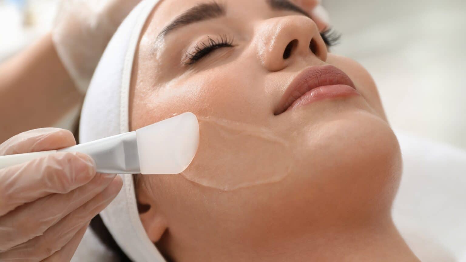 Peels